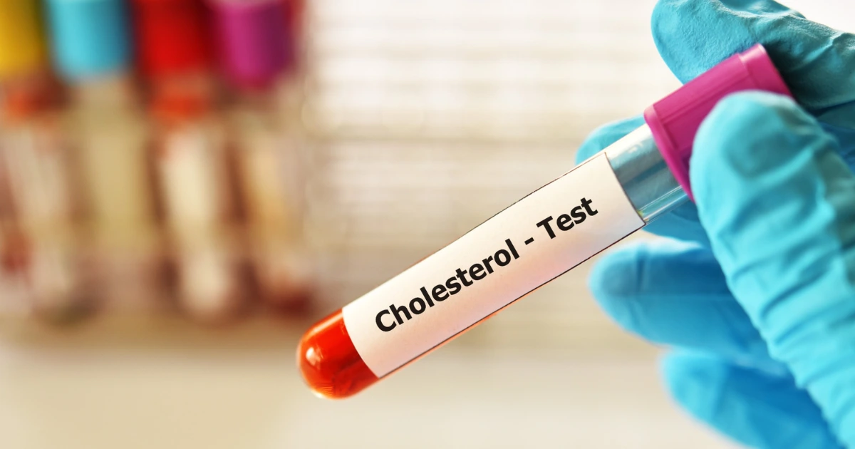 Naturopathic medicine is becoming more popular among both patients and healthcare providers for managing high cholesterol (dyslipidemia)