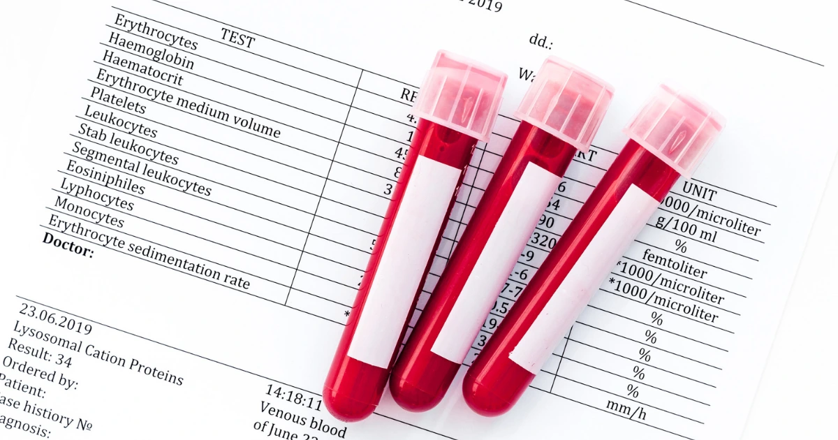 Aspire Natural Health Naturopathic Blood Screening Tests Featured Image