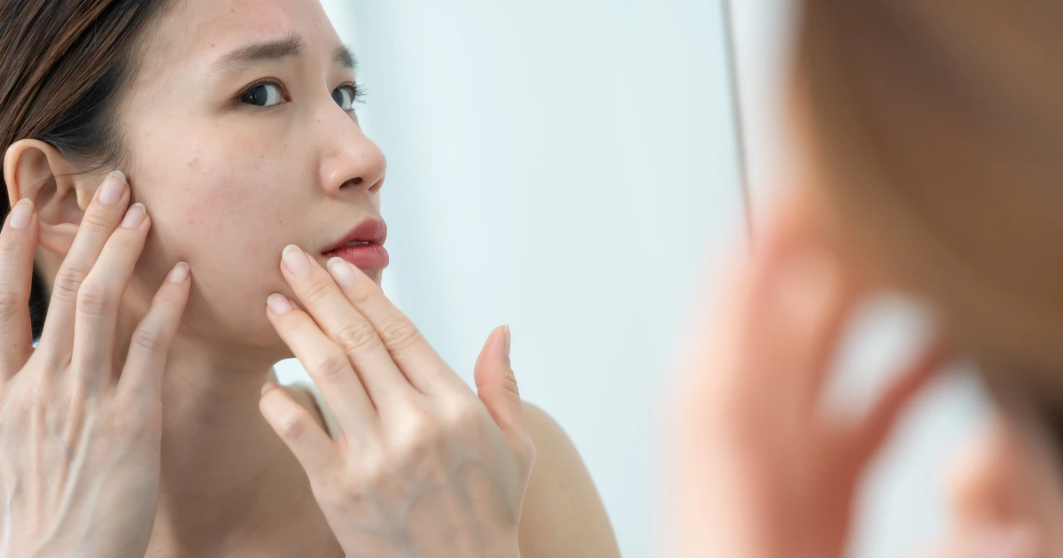 Aspire Natural Health Ultimate Guide to Naturopathic Dermatology Featured Image