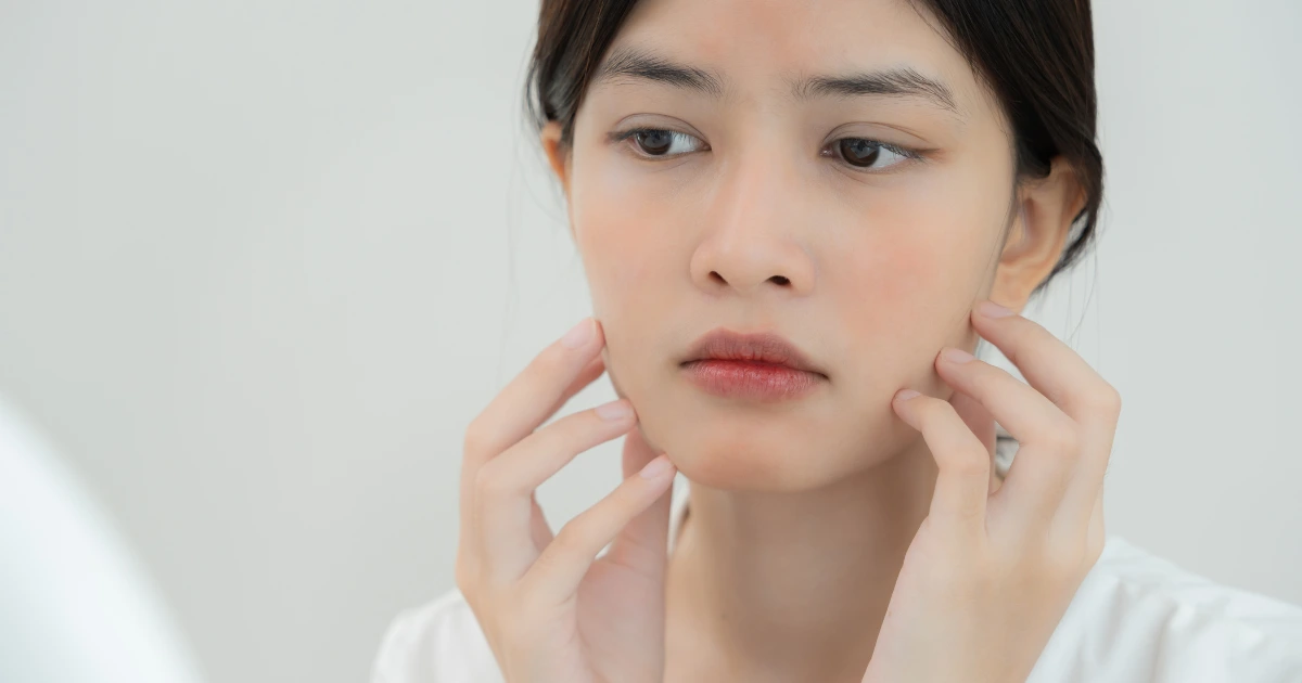 Naturopathic dermatology focuses on treating skin concerns by addressing the root causes balancing hormones, boosting immunity and reducing stress for healthier skin naturally