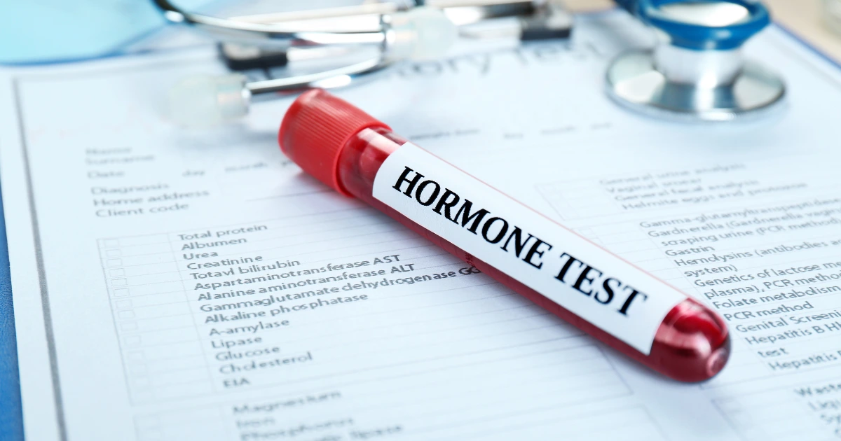 Aspire Natural Health Naturopath Hormone Testing Featured Image