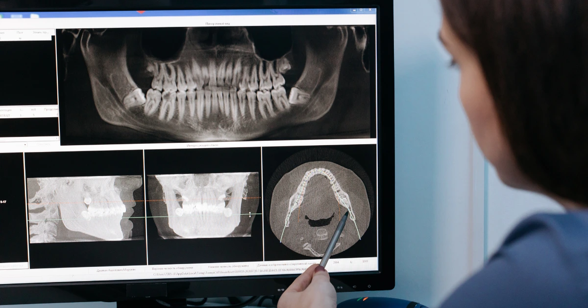 Comprehensive dental X-rays displayed on a monitor, assisting precise diagnosis and treatment planning for oral health concerns