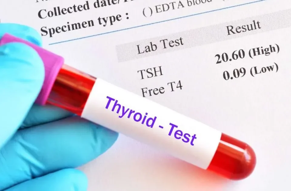 low thyroid