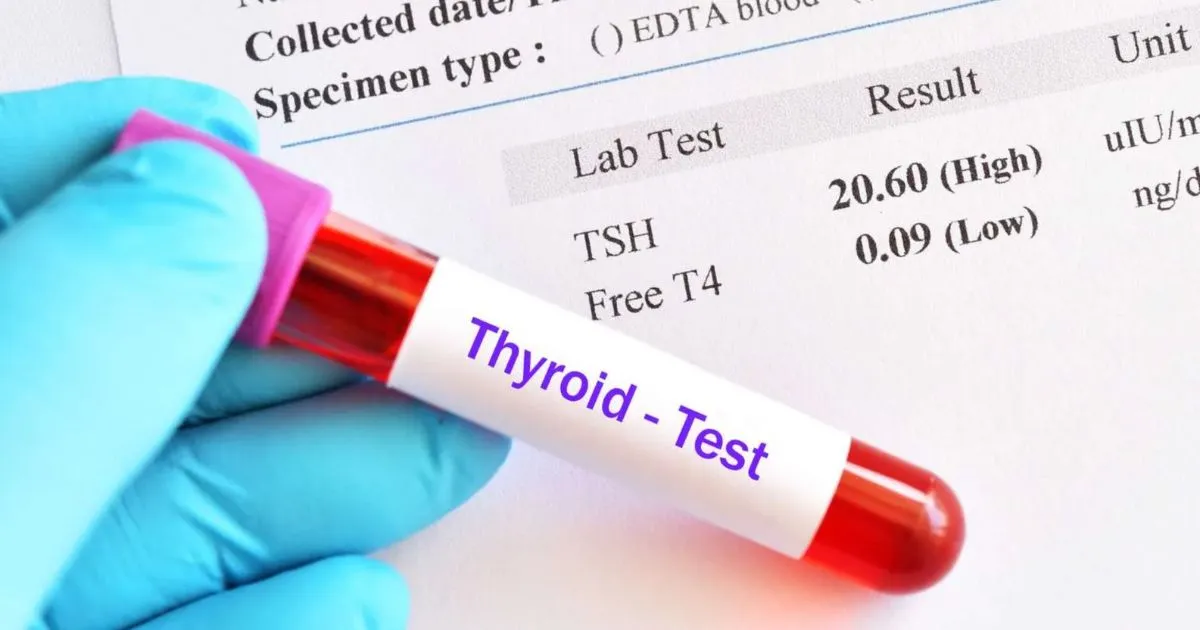 low thyroid